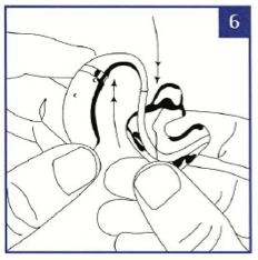 Changing_the_earmould_tubing_-_Step_6.png
